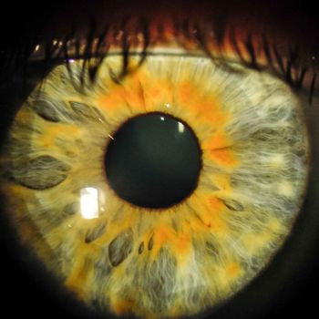 Iris Auge 6